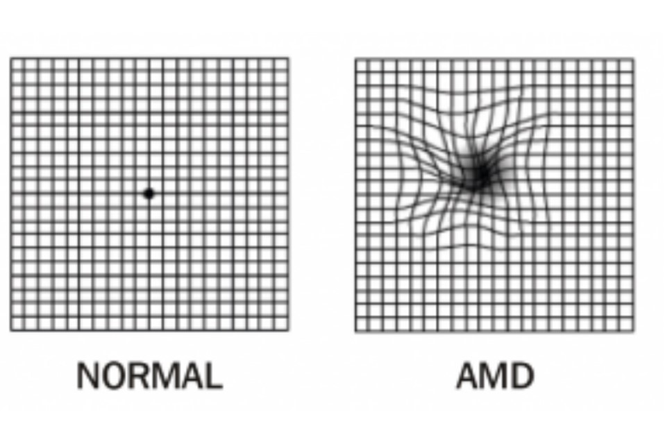 AMD vision